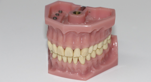 Qual o valor de 1 prótese dentária?